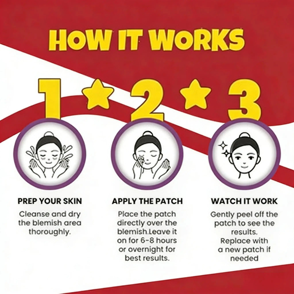 144/360PCS Day & Night Acne Patches for Face, Covers Zits & Blemishes, Safe & Gentle, Lightweight & Comfortable