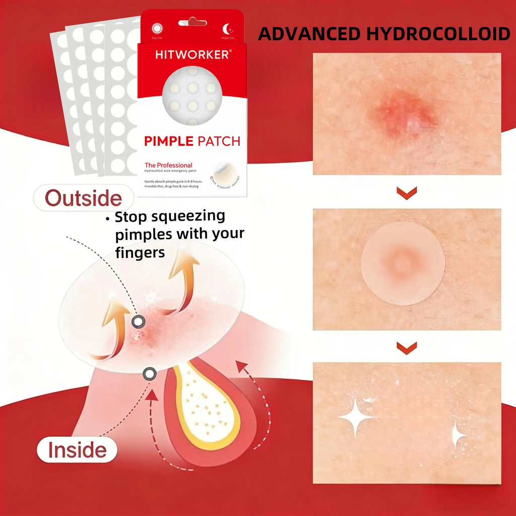 144/360PCS Day & Night Acne Patches for Face, Covers Zits & Blemishes, Safe & Gentle, Lightweight & Comfortable